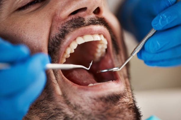 Best Cracked Tooth Emergency Dentist  in Indian Springs, GA